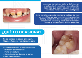 Hipomineralización Molar Incisivo